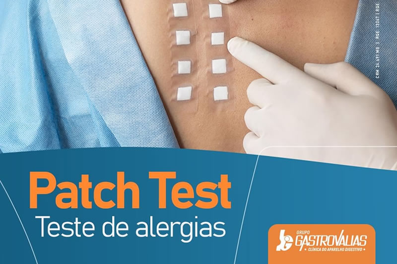 Patch Test - Testes de Alergias